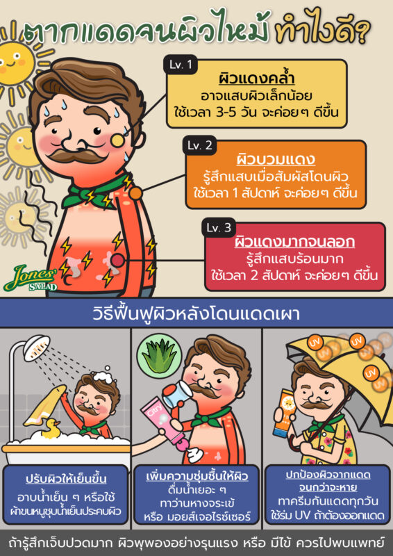 ตากแดดจนผิวไหม้ ทำยังไงดี.jpg
