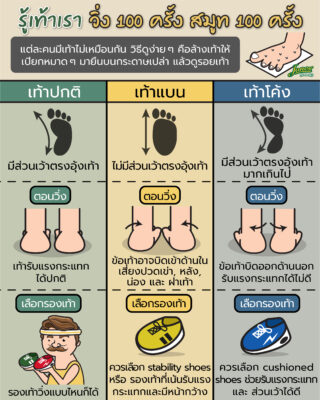 รู้จักรูปแบบเท้าของตัวเอง วิ่งได้ไม่มีสะดุด.jpg