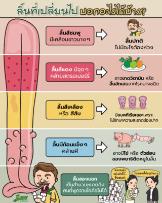ลิ้นที่เปลี่ยนไป บอกอะไรได้บ้าง.jpg