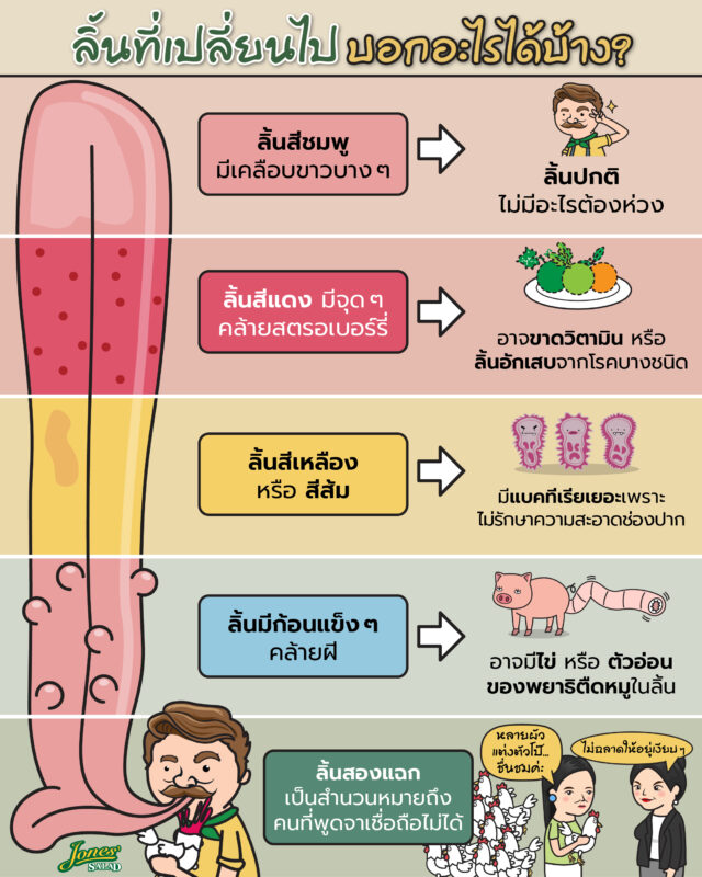 ลิ้นที่เปลี่ยนไป บอกอะไรได้บ้าง.jpg