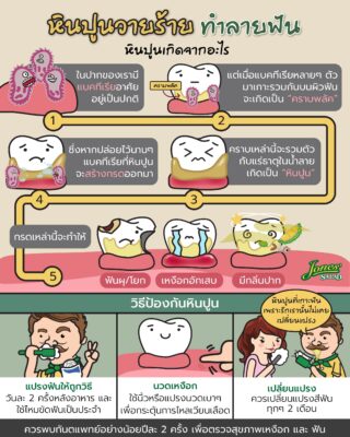หินปูวายร้าย ทำลายฟัน.jpg